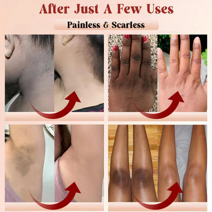 GlowPeel™ — Orange Enzyme Exfoliating & Whitening Gel